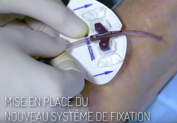 refection pst Picc line dom